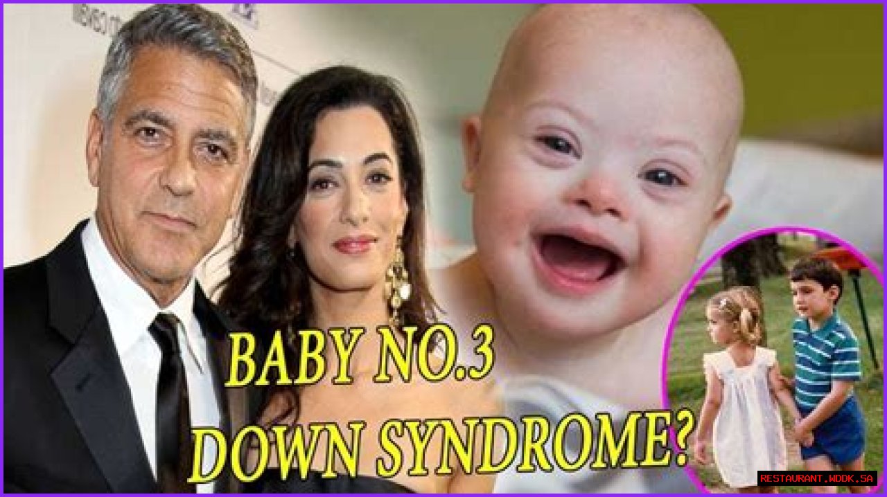 George Clooney's Son: Navigating Life With Down Syndrome